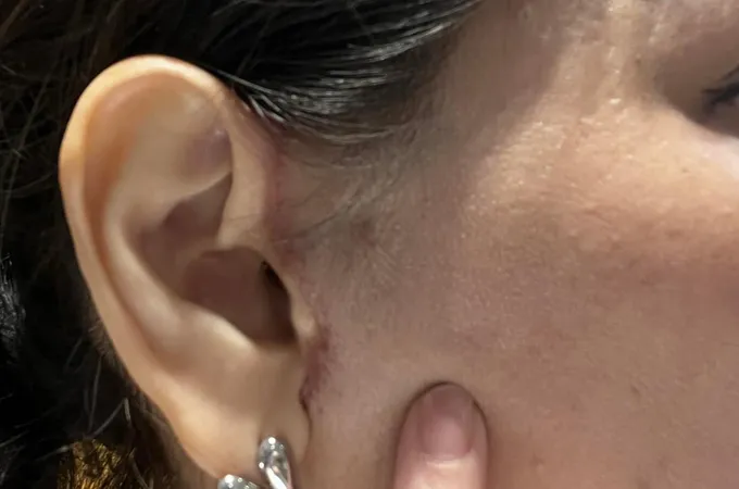 曼星整形醫美診所 照片 8