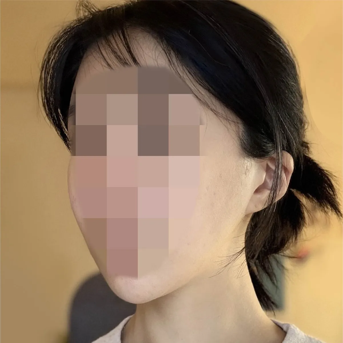OPERA Plastic Surgery Clinic 照片 3