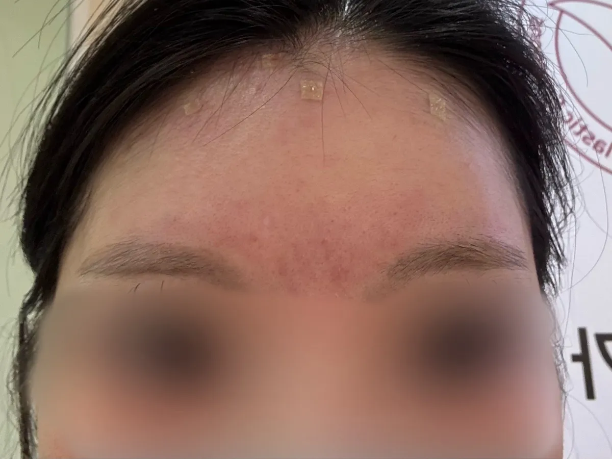 IDEL Plastic Surgery & Aesthetic 照片 5