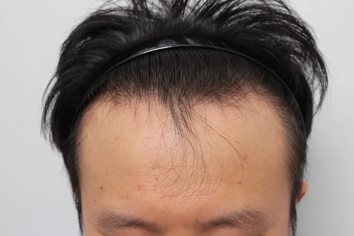 Busan Maxwell 皮膚科 照片 5