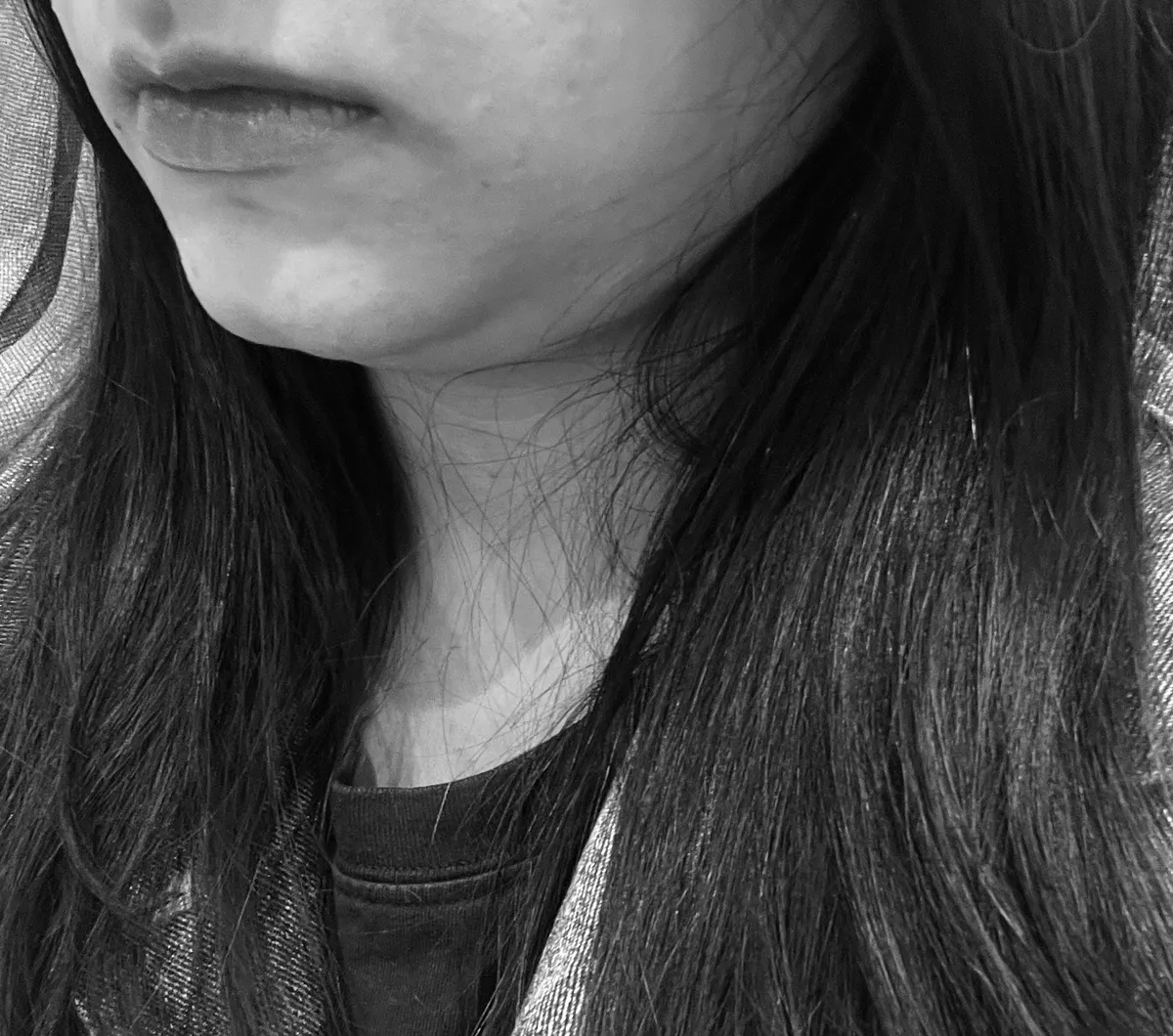 Koko Plastic Surgery Clinic 照片 4