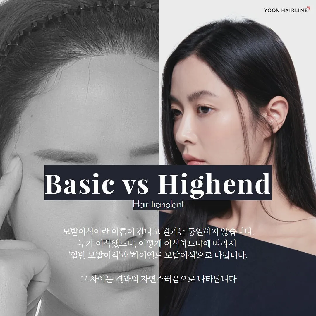 Yoon Hairline Clinic 照片 5