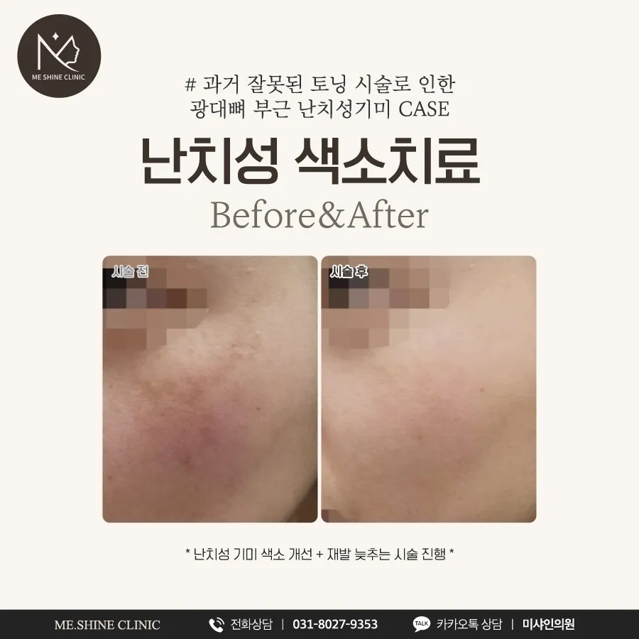 Mi Shine 診所 照片 5