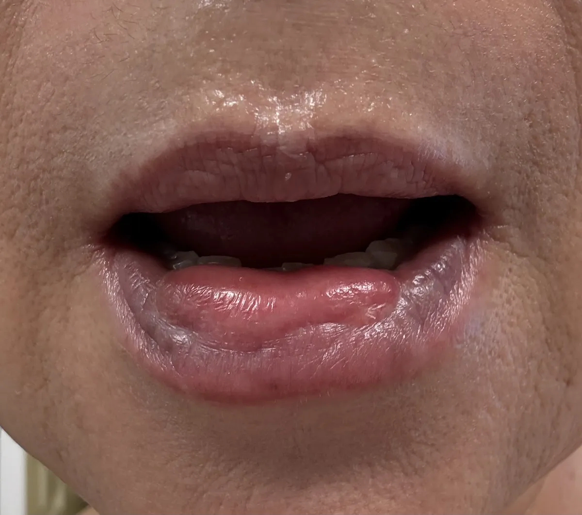 Kohiksu 整形外科 照片 3