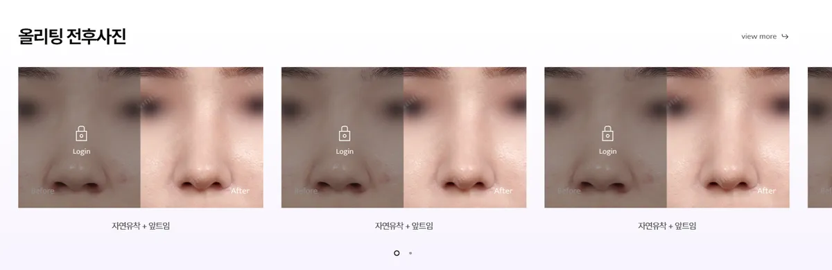 AllLitting Plastic Surgery Clinic 照片 2