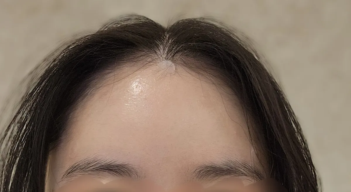 AllLitting Plastic Surgery Clinic 照片 5