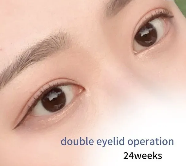 PR Plastic Surgery 照片 4