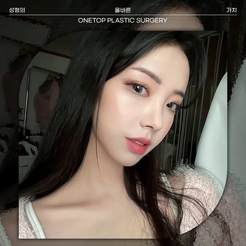 Onetop Plastic Surgery 照片 4