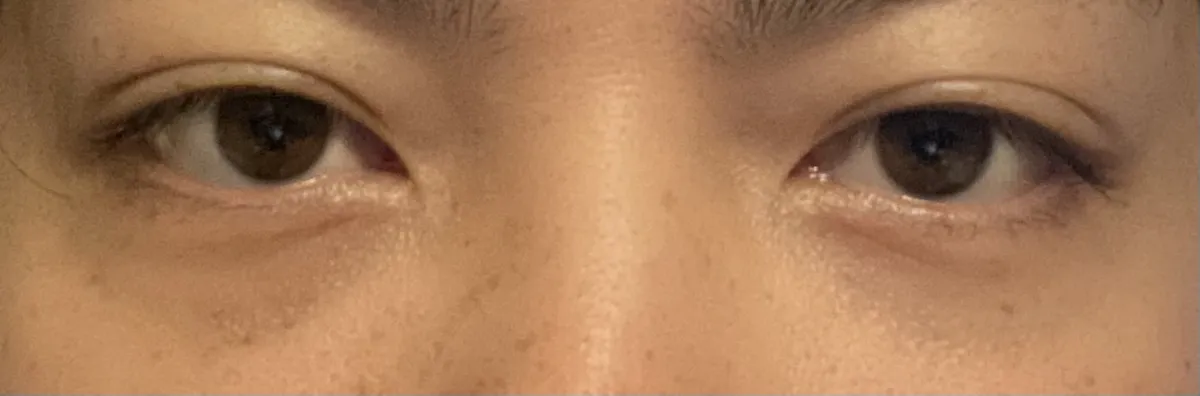 AND Plastic Surgery Clinic 照片 5