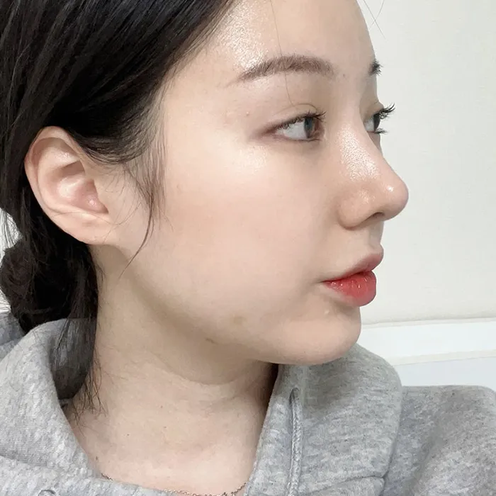 JT Plastic Surgery 照片 4