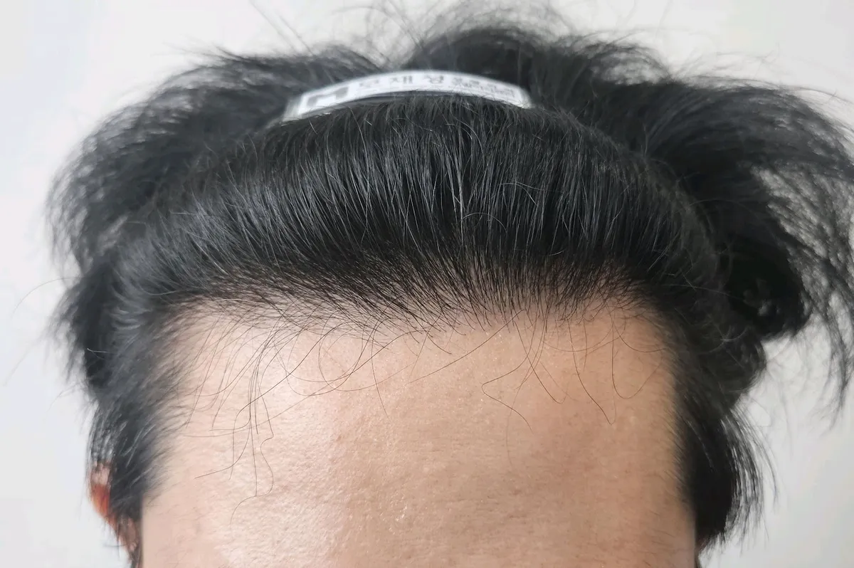 모재성성형외과의원 照片 1
