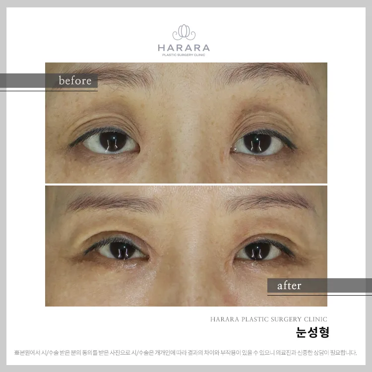 Harara Plastic Surgery Clinic 照片 5
