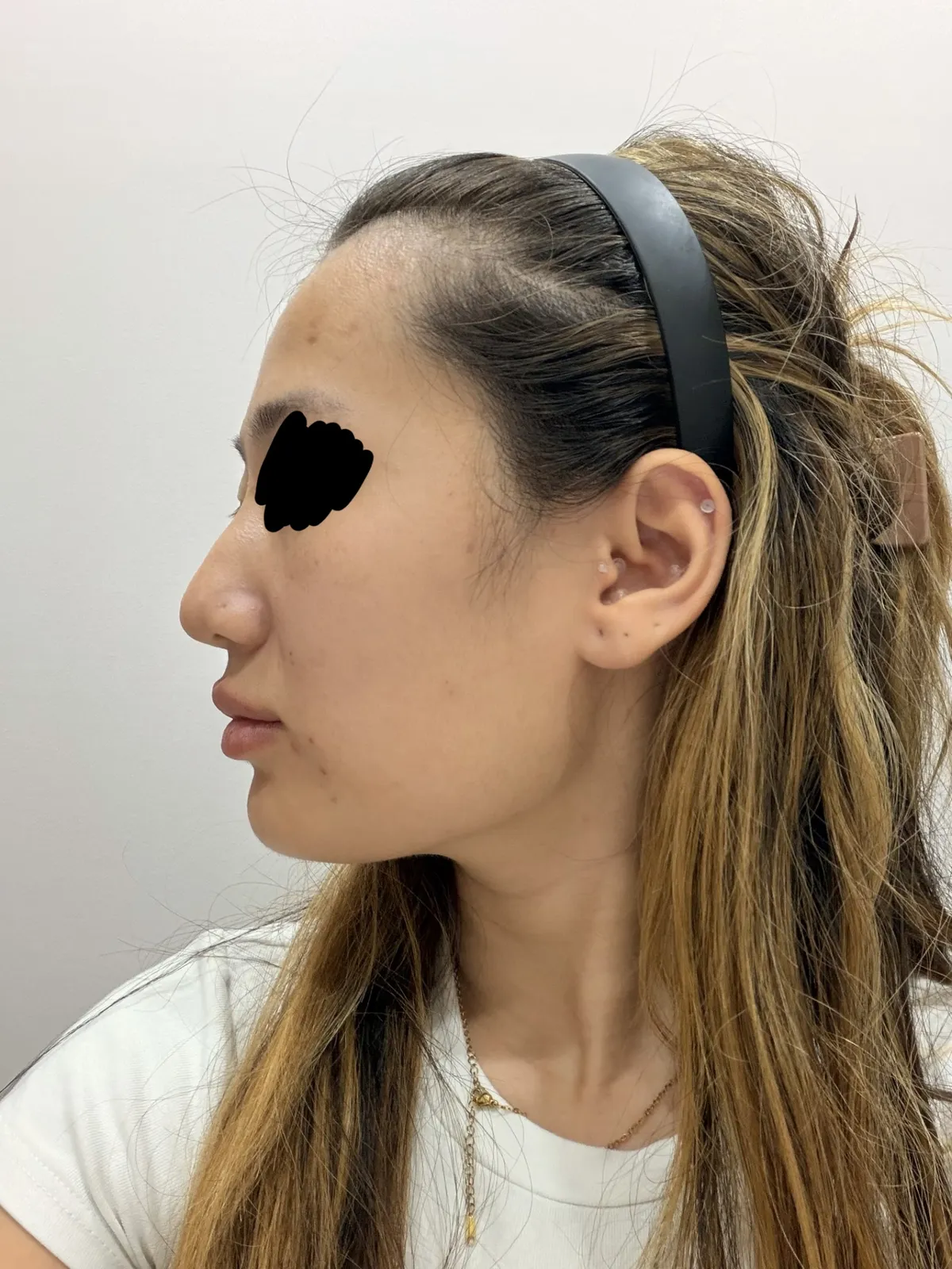 瑪博爾整形外科 照片 5