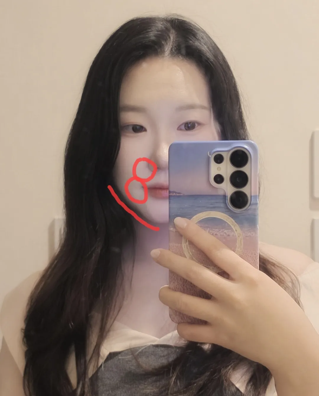 Nain Skin Clinic & Aesthetic - Yeonsinnae Branch 照片 2