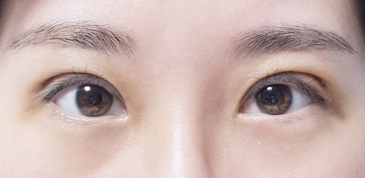 Promise Plastic Surgery 照片 4
