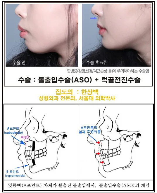 Seoul Jeil 整形外科 照片 3