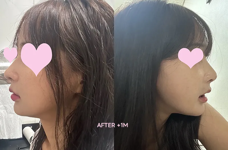 Cocoline Plastic Surgery 照片 1
