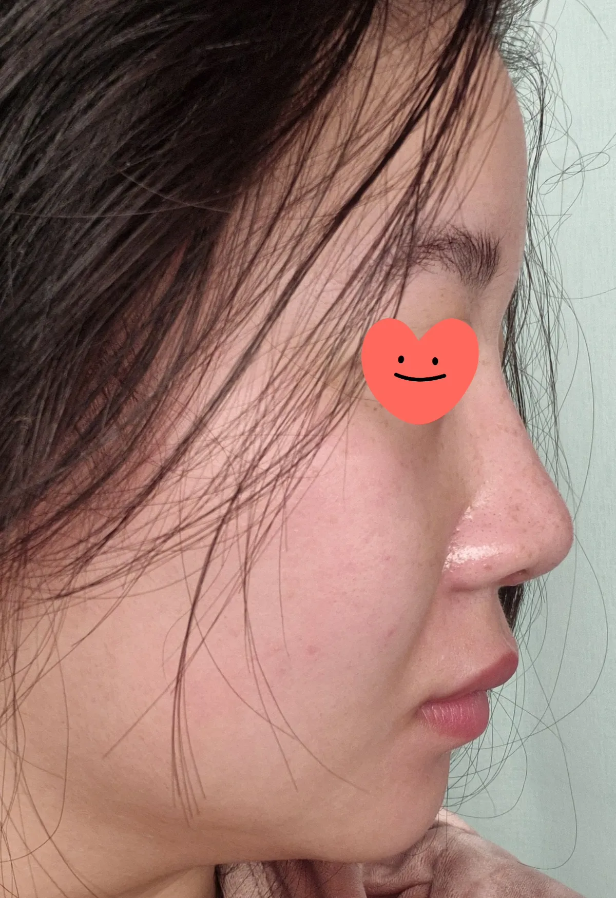 Cocoline Plastic Surgery 照片 2