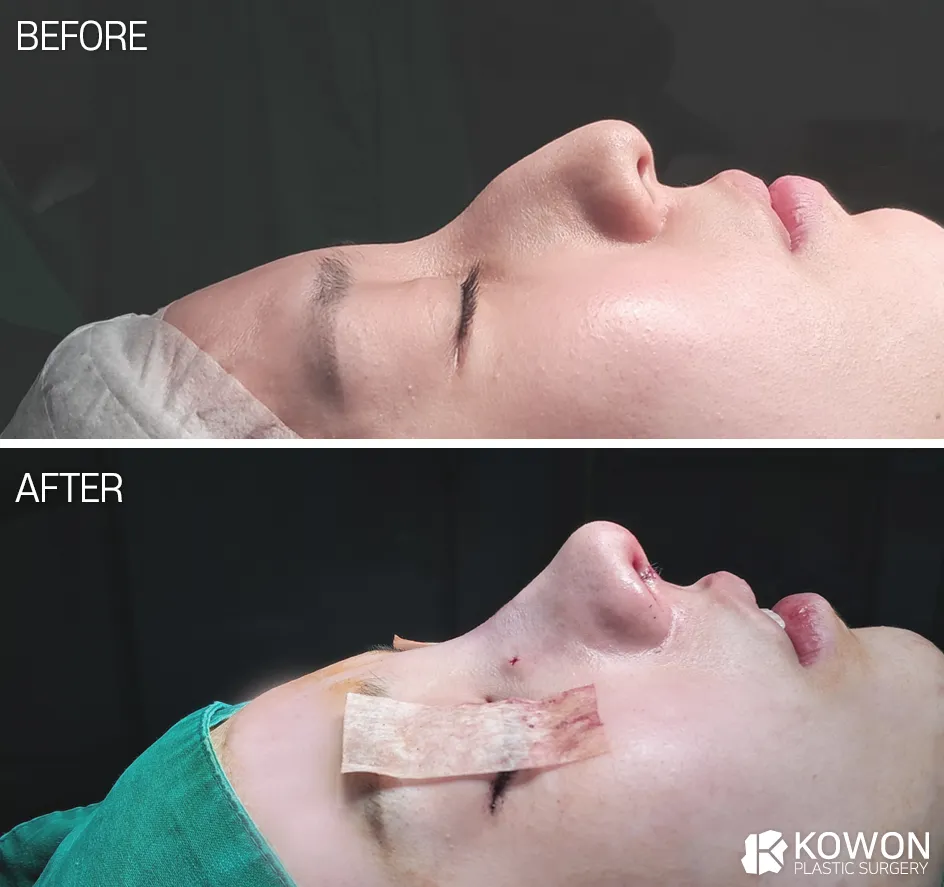 Kowon Plastic Surgery 照片 3