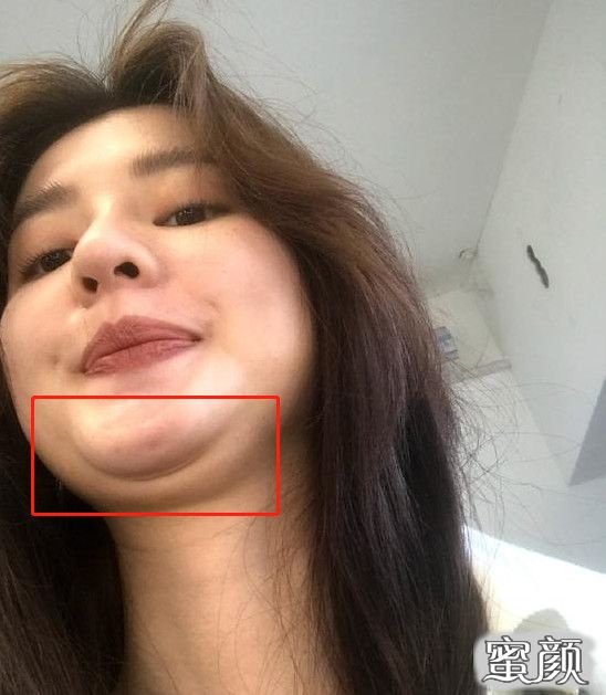 來自 Imgur 的圖片