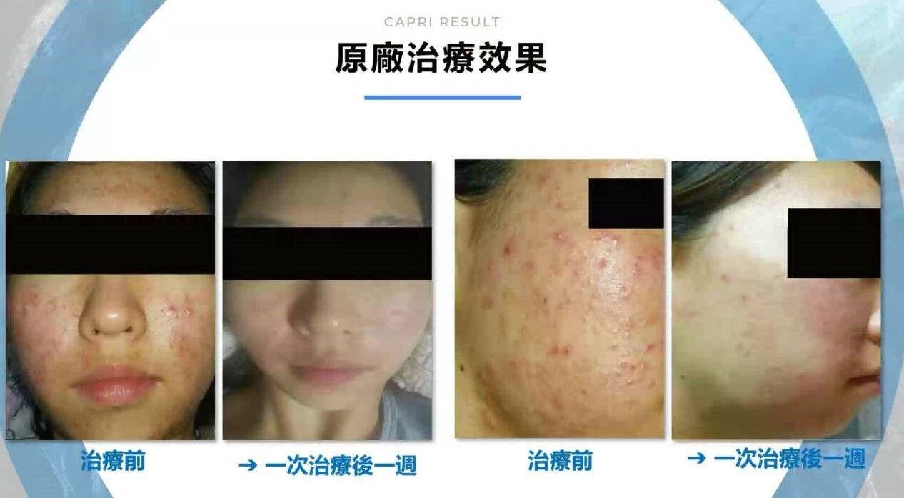 來自 Imgur 的圖片