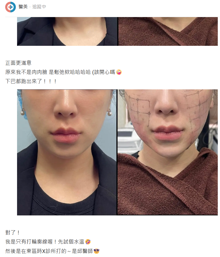 打過玩美電波的進來