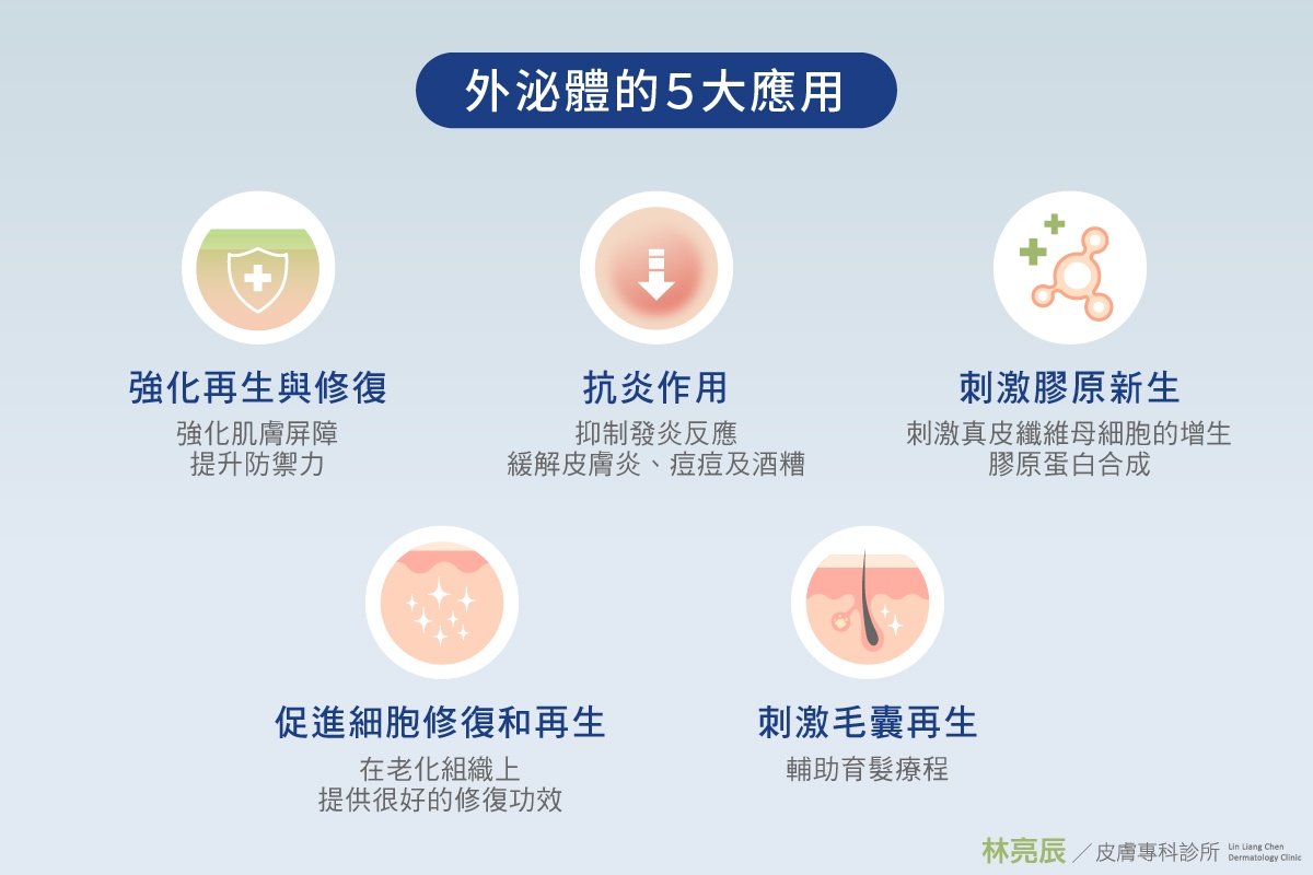 來自 Imgur 的圖片