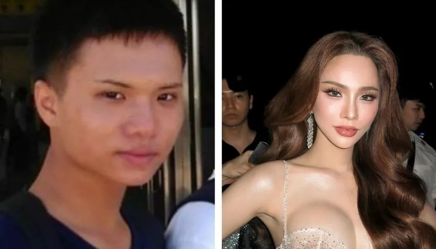 台北哪家診所的肉毒瘦臉效果自然？