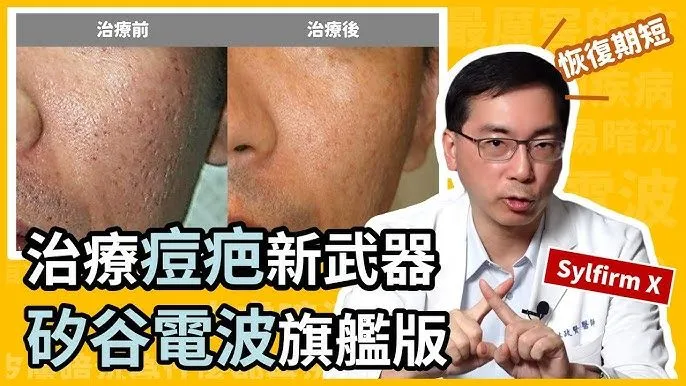 雷射除斑會不會反黑？很怕臉更慘QQ