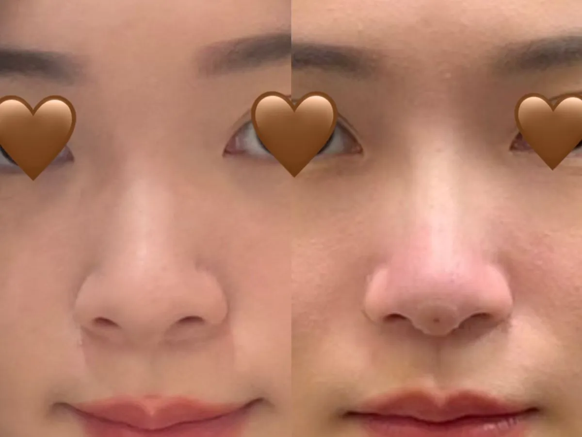 #分享 正面終於有鼻影了！自然系鼻雕心得