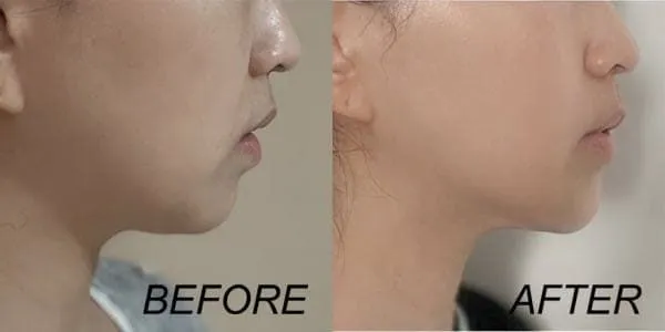 台灣Onda OndaPRO價格整理大雜燴分享