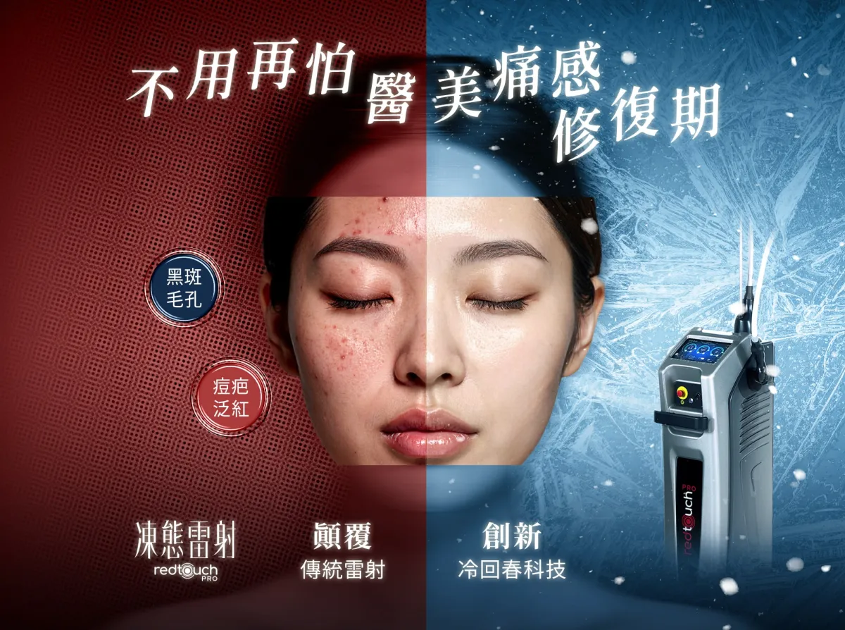 凍態雷射跟閨蜜電波做私密處差在哪